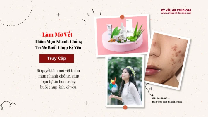 Làm Mờ Vết Thâm Mụn Nhanh Chóng Trước Kỷ Yếu 3 Làm mờ vết thâm mụn chụp ảnh Kỷ yếu